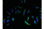 Immunofluorescent analysis of Hela cells using CSB-PA007650LA01HU at a dilution of 1:100 and Alexa Fluor 488-congugated AffiniPure Goat Anti-Rabbit IgG(H+L)