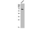 Western Blot analysis of Jurkat cells using DBH Polyclonal Antibody