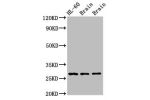 Western Blot<br />
Positive WB detected in:Rat brain tissue,Mouse brain tissue<br />
All lanes:EMX2 antibody at 2.7