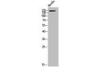 Western Blot analysis of HuvEc cells using ACE1 Polyclonal Antibody