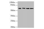 Western blot<br />
All lanes: ENC1 antibody at 5ug/ml<br />
Lane 1 : MCF7 whole cell lysate<br />
Lane 2 : HepG-2 whole cell lysate<br />
Lane 3 : Mouse brain tissue<br />
Lane 4 : A549 whole cell lysate<br />
Secondary<br />
Goat polyclonal to Rabbit IgG