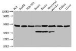 Western Blot<br />
Positive WB detected in:PC3 whole cell lysate,HepG2 whole cell lysate,NIH/3T3 whole cell lysate,Rat heart tissue,Rat brain tissue,Rat skeletal muscle tissue,Mouse kidney tissue,Mouse liver tissue<br />
All lanes: Eno1 antibody at 0.42