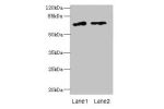 Western blot<br />
All lanes: ENOX1 antibody at 5ug/ml<br />
Lane 1 : Jurkat whole cell lysate<br />
Lane 2 : Raji whole cell lysate<br />
Secondary<br />
Goat polyclonal to Rabbit IgG at 1/10000 dilution<br />
Predicted band size: 74,28 kDa<br />
Observe