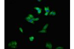Immunofluorescent analysis of HepG2 cells using CSB-PA007679LA01HU at a dilution of 1:100 and Alexa Fluor 488-congugated AffiniPure Goat Anti-Rabbit IgG(H+L)