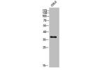 Western Blot analysis of COLO cells using DD2 Polyclonal Antibody