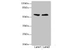 Western blot<br />
All lanes: