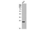 Western Blot analysis of COLO cells using CaBP7 Polyclonal Antibody