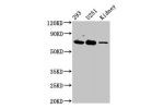 Western Blot<br />
Positive WB detected in:293 whole cell lysate,U251 whole cell lysate,Rat kidney tissue<br />
All lanes:EOMES antibody at 4.5
