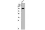 Western Blot analysis of Jurkat cells using DDX3 Polyclonal Antibody