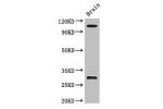 Western Blot<br />
Positive WB detected in:Mouse brain tissue<br />
All lanes: EPHA1 antibody at 3ug/ml<br />
Secondary<br />
Goat polyclonal to rabbit IgG at 1/50000 dilution<br />
Predicted band size: 109,53,52 kDa<br />
Observed band size: 109,30 kDa<b