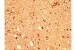 IHC image of CSB-PA007722LA01HU diluted at 1:400 and staining in paraffin-embedded human brain tissue performed on a Leica BondTM system. After dewaxing and hydration, antigen retrieval was mediated by high pressure in a citrate buffer (pH 6.0). Section w