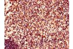 Immunohistochemistry of paraffin-embedded human spleen tissue using CSB-PA007724LA01HU at dilution of 1:100