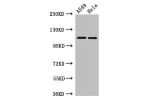 Western Blot<br />
Positive WB detected in:A549 whole cell lysate,Hela whole cell lysate<br />
All lanes:EPHA5 antibody at 3