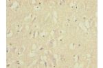 Immunohistochemistry of paraffin-embedded human brain tissue CSB-PA007729ESR2HU at dilution 1:100