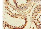 Immunohistochemistry of paraffin-embedded human testicular tissue using CSB-PA007730LA01HU at dilution of 1:100