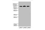 Western blot<br />
All lanes: EPHB4 antibody at 2.71ug/ml<br />
Lane 1 : A549 whole cell lysate<br />
Lane 2 : 293T whole cell lysate<br />
Lane 3 : Hela whole cell lysate<br />
Secondary<br />
Goat polyclonal to rabbit IgG at 1/10000 dilution<br />
Predi