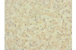 Immunohistochemistry of paraffin-embedded human liver tissue CSB-PA007732ESR2HU at dilution 1:100