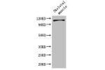 Western Blot<br />
Positive WB detected in:Mouse skeletal muscle tissue<br />
All lanes: EPHB6 antibody at 2ug/ml<br />
Secondary<br />
Goat polyclonal to rabbit IgG at 1/50000 dilution<br />
Predicted band size: 111,82,58 kDa<br />
Observed band size: 11