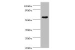 Western blot<br />
All lanes:Epoxide hydrolase 1 antibody at 2ug/ml+Hela whole cell lysate<br />
Secondary<br />
Goat polyclonal to rabbit at 1/10000 dilution<br />
Predicted band size: 53kDa<br />
Observed band size: 53kDa<br />