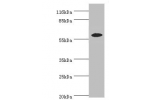 Western blot<br />
All lanes:EPHX2 antibody at 2ug/ml+MCF-7 whole cell lysate<br />
Secondary<br />
Goat polyclonal to rabbit at 1/10000 dilution<br />
Predicted band size: 63,58,56 kDa<br />
Observed band size: 57 kDa<br />