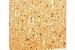 Immunohistochemistry of paraffin-embedded human brain tissue using CSB-PA007738LA01HU at dilution 1:100