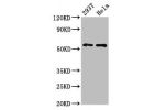 Western Blot<br />
Positive WB detected in:293T whole cell lysate,Hela whole cell lysate<br />
All lanes:EPOR antibody at 4.3