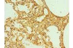 Immunohistochemistry of paraffin-embedded human lung using CSB-PA007765ESR1HU at dilution 1:100