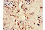 Immunohistochemistry of paraffin-embedded human placenta tissue using CSB-PA007766LA01HU at dilution of 1:100