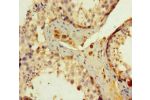 Immunohistochemistry of paraffin-embedded human testis tissue using CSB-PA007769LA01HU at dilution of 1:100