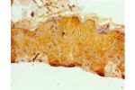 Immunohistochemistry of paraffin-embedded human skin using CSB-PA007770ESR1HU at dilution 1:100