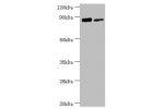 All lanes:TFIIH basal transcription factor complex helicase XPD subunit antibody at 2ug/ml<br />
Lane 1:293T whole cell lysate<br />
Lane 2:K562 whole cell lysate<br />
Secondary<br />
Goat polyclonal to rabbit at 1/10000 dilution<br />
Predicted band siz