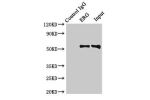 Immunoprecipitating ERG in rat heart tissue<br />
Lane 1: Rabbit control IgG(1