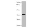 Western blot<br />
All lanes: ERLIN1 antibody at 4ug/ml+ Mouse brain tissue<br />
Goat polyclonal to rabbit at 1/10000 dilution<br />
Predicted band size: 39 kDa<br />
Observed band size: 39 kDa<br />