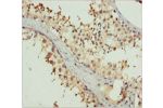 Immunohistochemistry of paraffin-embedded human