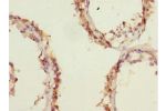 Immunohistochemistry of paraffin-embedded human testis tissue using CSB-PA007794ESR1HU at dilution 1:100