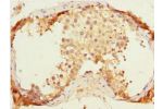 Immunohistochemistry of paraffin-embedded human testis tissue using CSB-PA007794ESR2HU at dilution 1:100