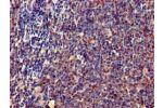 Immunohistochemistry of paraffin-embedded human lymph node tissue using CSB-PA007795LA01HU at dilution of 1:100