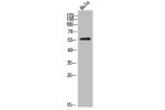 Western Blot analysis of HeLa cells using Dyskerin Polyclonal Antibody