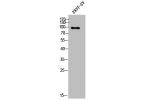 Western Blot analysis of 293T-UV cells using PSD-93 Polyclonal Antibody