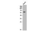 Western Blot analysis of HepG2 cells using TdT Polyclonal Antibody