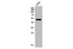 Western Blot analysis of HT-29 cells using CRMP-2 Polyclonal Antibody