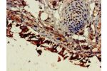 Immunohistochemistry of paraffin-embedded human lung tissue using CSB-PA007825HA01HU at dilution of 1:100