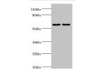 Western blot<br />
All lanes:Estrogen receptor beta antibody at 2ug/ml<br />
Lane 1:mouse brain tissue<br />
Lane 2:PC-3 whole cell lysate<br />
Secondary<br />
Goat polyclonal to rabbit at 1/10000 dilution<br />
Predicted band size: 60,56,36,58,55,53,49,