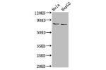 Western Blot<br />
Positive WB detected in:Hela whole cell lysate,HepG2 whole cell lysate<br />
All lanes:ESRP2 antibody at 6