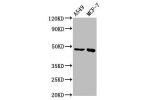 Western Blot<br />
Positive WB detected in:A549 whole cell lysate,MCF-7 whole cell lysate<br />
All lanes:ESRRB antibody at 3.7