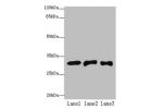 Western blot<br />
All lanes: ETHE1 antibody at 8ug/ml<br />
Lane 1 : Mouse liver tissue<br />
Lane 2 : HepG-2 whole cell lysate<br />
Lane 3 : Hela whole cell lysate<br />
Secondary<br />
Goat polyclonal to Rabbit IgG at 1/10000 dilution<br />
Predicted 