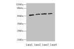 Western blot<br />
All lanes: ETNK1 antibody at 0.5ug/ml<br />
Lane 1 : A549 whole cell lysate<br />
Lane 2 : A431 whole cell lysate<br />
Lane 3 : HepG-2 whole cell lysate<br />
Lane 4 : MCF7 whole cell lysate<br />
Secondary<br />
Goat polyclonal to Rab