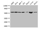Western Blot<br />
Positive WB detected in:K562 whole cell lysate,Hela whole cell lysate,MCF-7 whole cell lysate,PC3 whole cell lysate,Mouse heart tissue,Mouse liver tissue,Mouse brain tissue<br />
All lanes: ETS2 antibody at 2.7ug/ml<br />
Secondary<br /