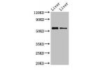 Western Blot<br />
Positive WB detected in:Mouse liver tissue,Rat liver tissue<br />
All lanes:ETV1 antibody at 3