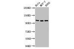 Western Blot<br />
Positive WB detected in:Hela whole cell lysate,MCF-7 whole cell lysate,K562 whole cell lysate<br />
All lanes:EVC antibody at 2
